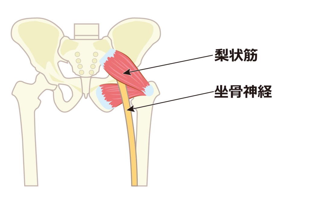 梨状筋